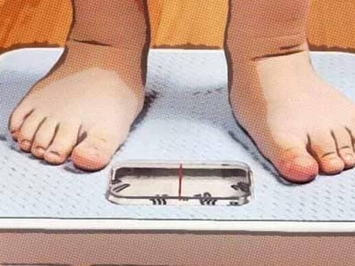 obesidad